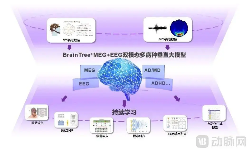 树脑科技获千万级天使轮融资:国产脑机双模态算法能否打破海外垄断?