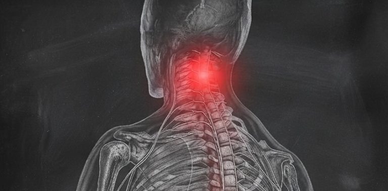 NovaGo Therapeutics 完成3000万美元B轮融资：抗Nogo-A疗法能否填补脊髓损伤再生空白？