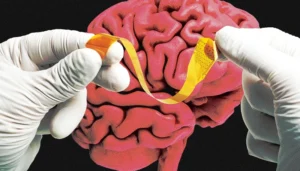 Precision Neuroscience完成2.5亿美元D轮：脑机接口从实验室走向临床规模化的关键节点